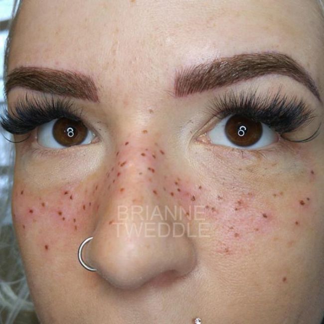 Tattooing Freckles On Your Face Is The Latest Beauty Craze (14 pics)