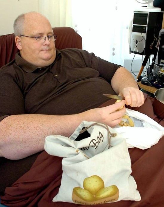 World’s Fattest Man Drops 700 lbs (5 pics)