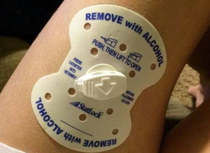 How To Remove With Alcohol (4 pics)