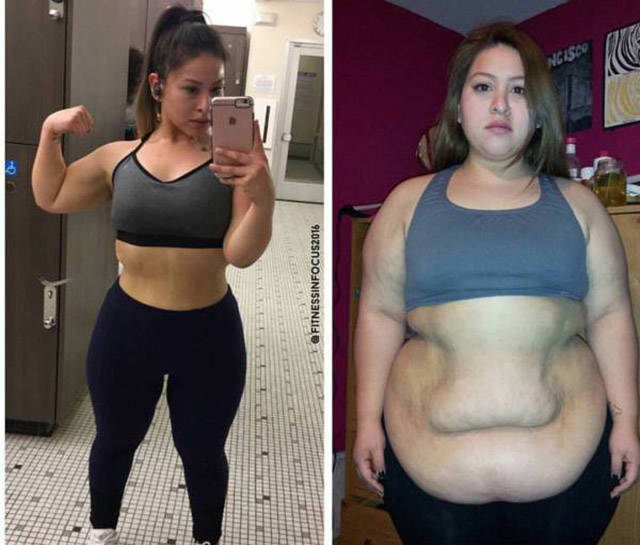 People Who Proved That No Weight Loss Is Impossible (39 pics)