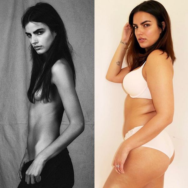 Model Embraces Her Curves After Starving Herself (2 pics)
