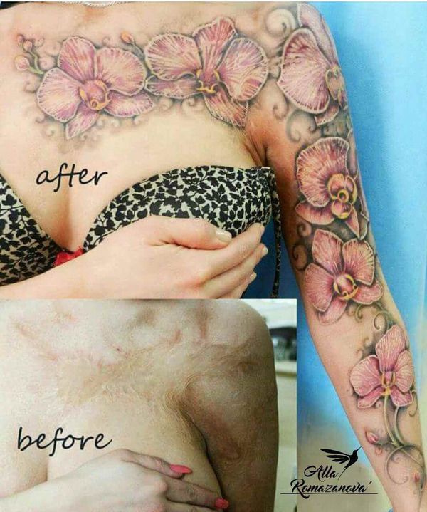 Beautiful Girl Uses Tattoos To Cover Up Her Scars (3 pics)