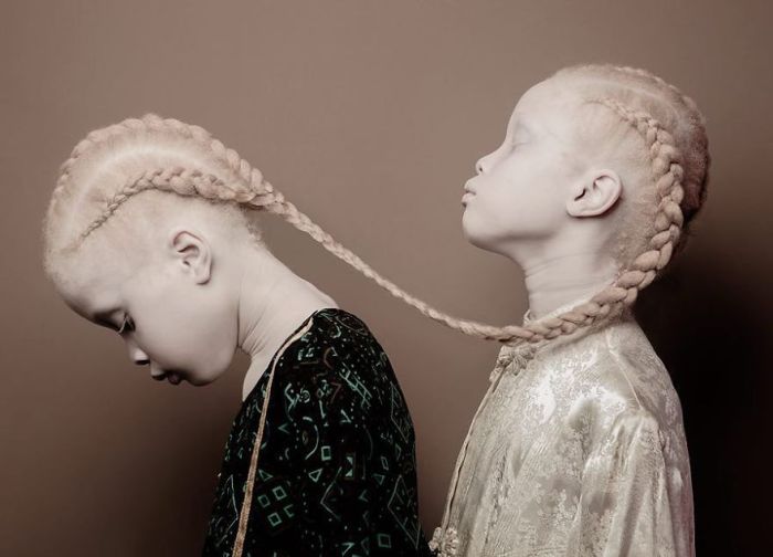 Brazilian Albino Twins From Are Taking The Fashion Industry By Storm (11 pics)