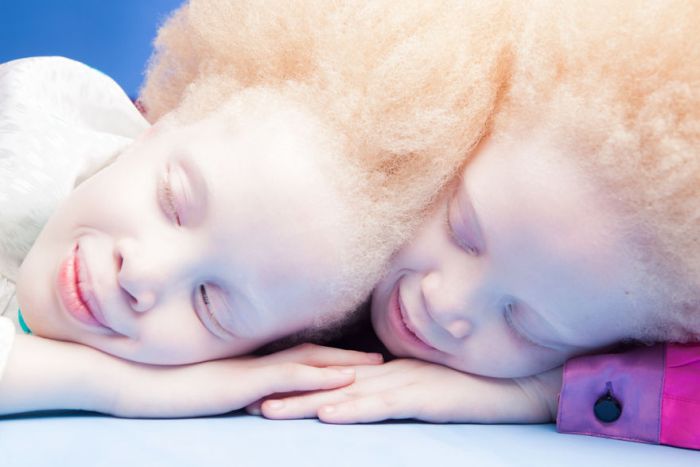 Brazilian Albino Twins From Are Taking The Fashion Industry By Storm (11 pics)