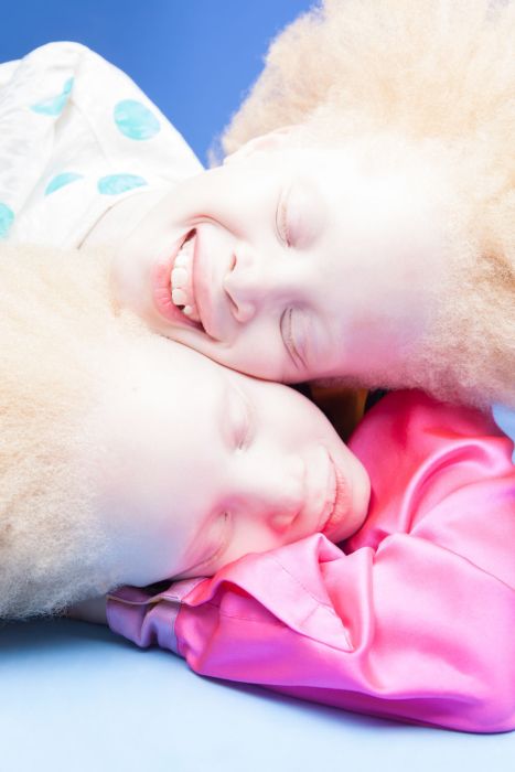 Brazilian Albino Twins From Are Taking The Fashion Industry By Storm (11 pics)