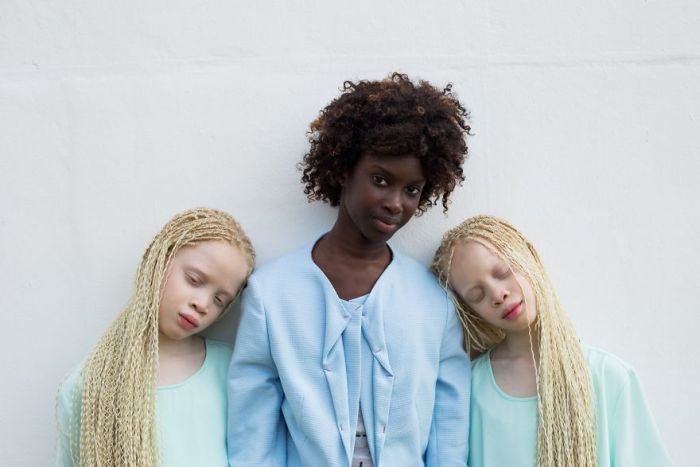 Brazilian Albino Twins From Are Taking The Fashion Industry By Storm (11 pics)