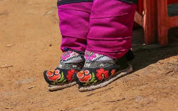 Chinese Women Who Walk With Deformed Feet (10 pics)