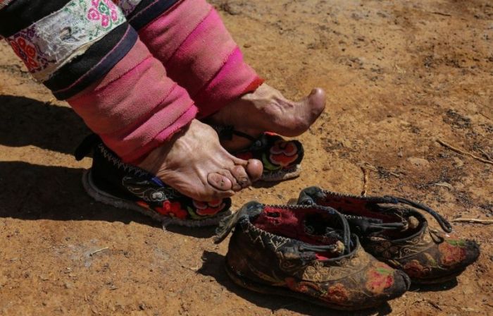 Chinese Women Who Walk With Deformed Feet (10 pics)
