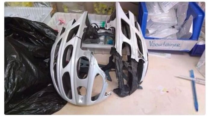 Here's Why You Should Always Wear A Helmet (15 pics)