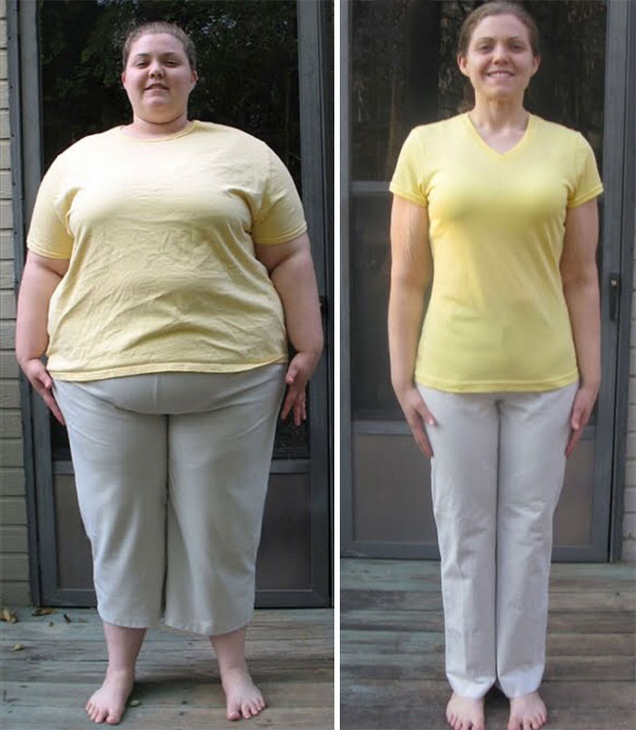 You Won't Believe These Before And After Photos Are The Same Person (35 pics)
