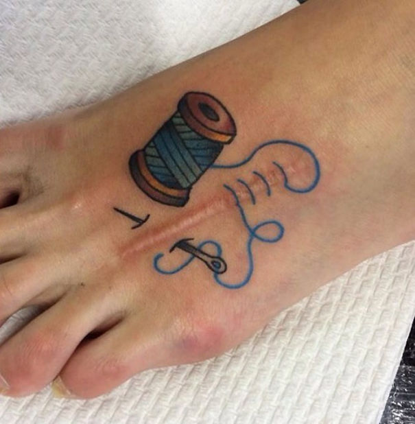 Tattoos Can Turn Scars Into Works Of Art (30 pics)