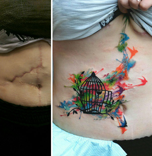 Tattoos Can Turn Scars Into Works Of Art (30 pics)