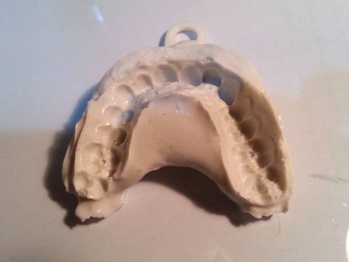 Student Proves You Don't Need Thousands Of Dollars To Fix Your Teeth (11 pics)