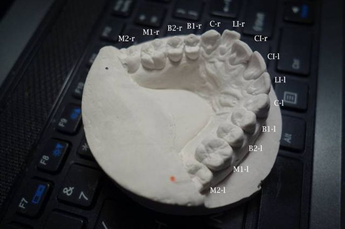 Student Proves You Don't Need Thousands Of Dollars To Fix Your Teeth (11 pics)