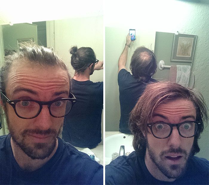 Men Are Trying To Hide Baldness With Man Buns Now (5 pics)