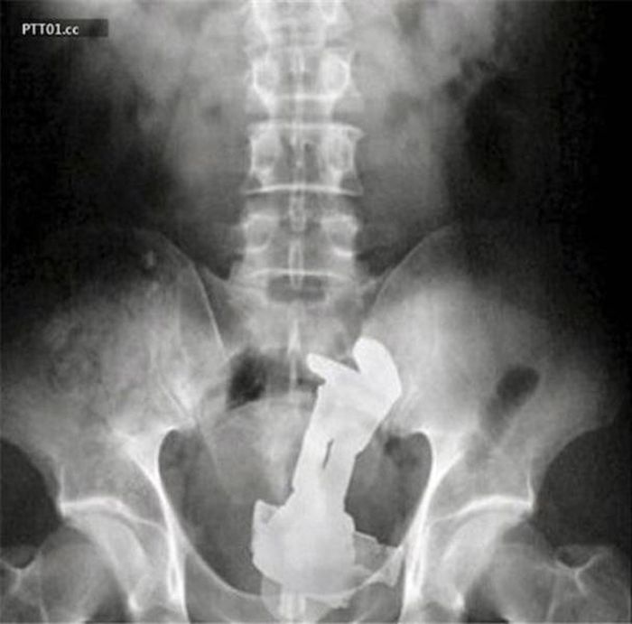 When X-Rays Reveal What You Don’t Want To See (22 pics)