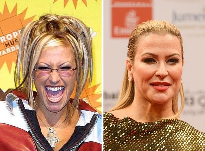 Your Favorite Celebrities Then And Now (11 pics) Your Favorite Celebrities Then And Now (11 pics)