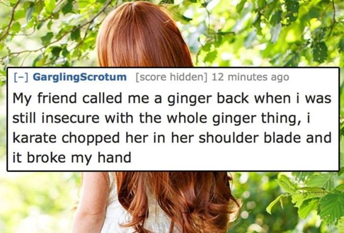 People Reveal The Dumbest Ways They Ever Hurt Themselves (10 pics)