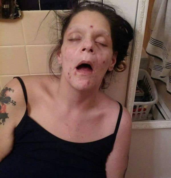 Woman Shows Major Improvements After Recovering From Dug Addiction (7 pics)