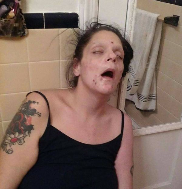 Woman Shows Major Improvements After Recovering From Dug Addiction (7 pics)