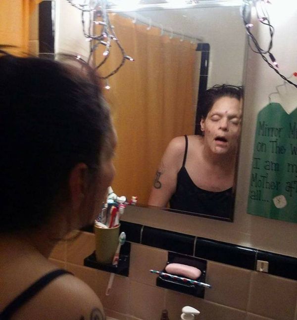 Woman Shows Major Improvements After Recovering From Dug Addiction (7 pics)