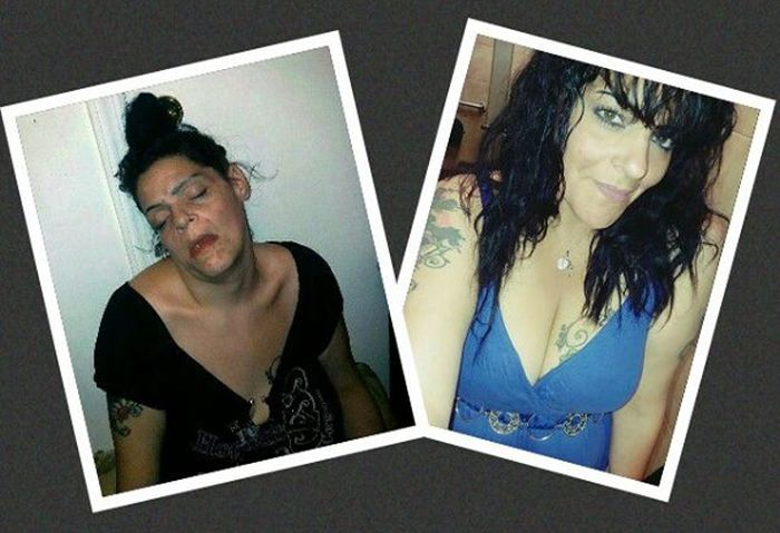 Woman Shows Major Improvements After Recovering From Dug Addiction (7 pics)