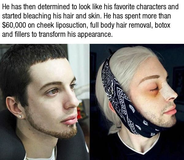 Guy Turns Himself Into An Elf After Spending $75,000 (10 pics)