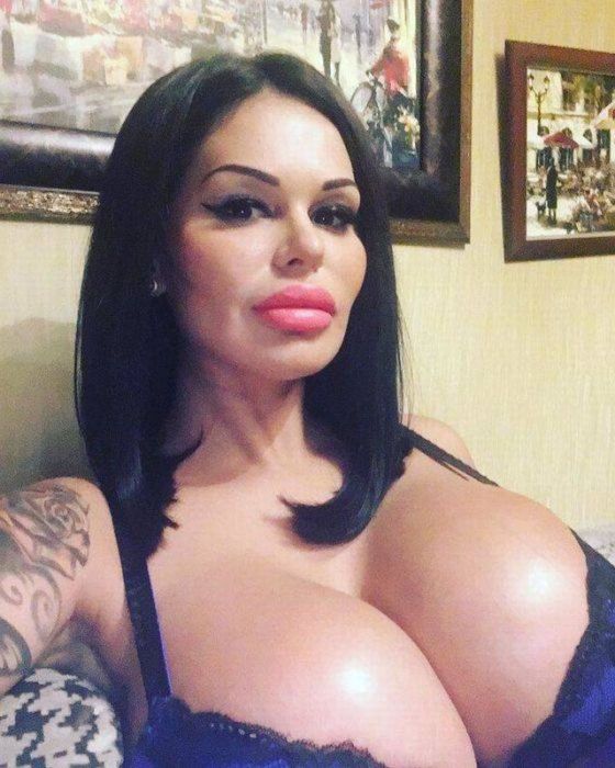 Women Who Overloaded Their Bodies With Silicone (45 pics)