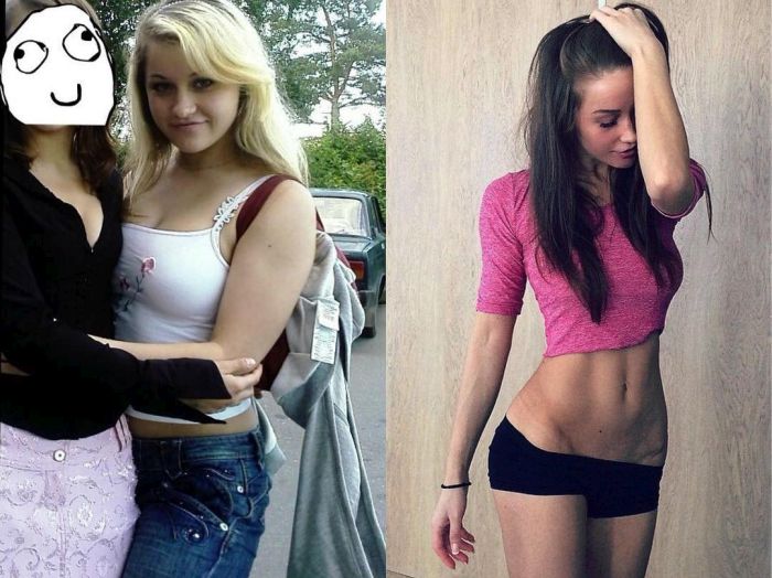 Girl Goes From Ugly Duckling To Gorgeous Supermodel (8 pics)