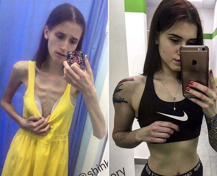 Russian Teenager Beats Anorexia To Become A Fitness Instructor (9 pics)