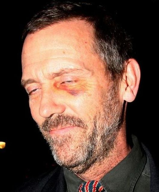 Bad Photos Of Celebrities (38 pics) Bad Photos Of Celebrities (38 pics)