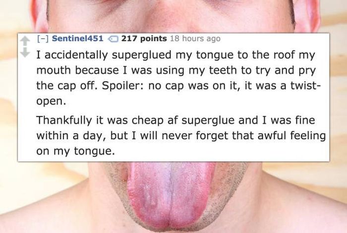 You Can Injure Yourself In Most Unimaginable Of Ways (13 pics)