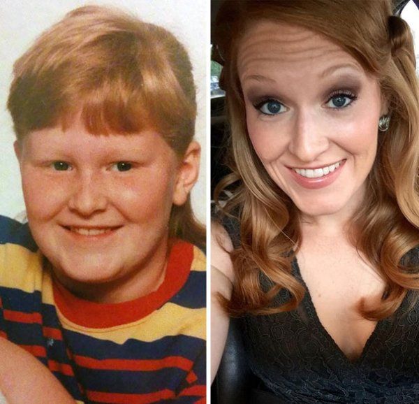 People In Their Awkward Stage (25 pics)