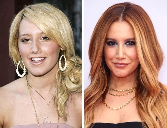 Celebrity Before And After Plastic Surgeries (10 pics)