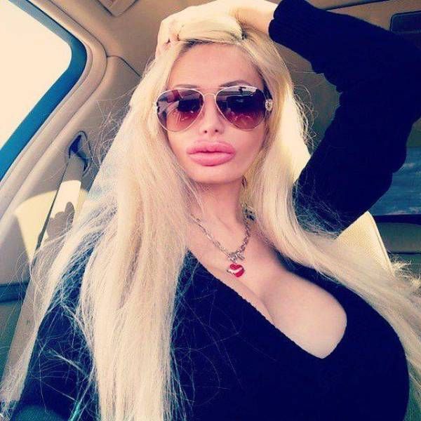 Silicone Beauties Or Horror Stories (22 pics)