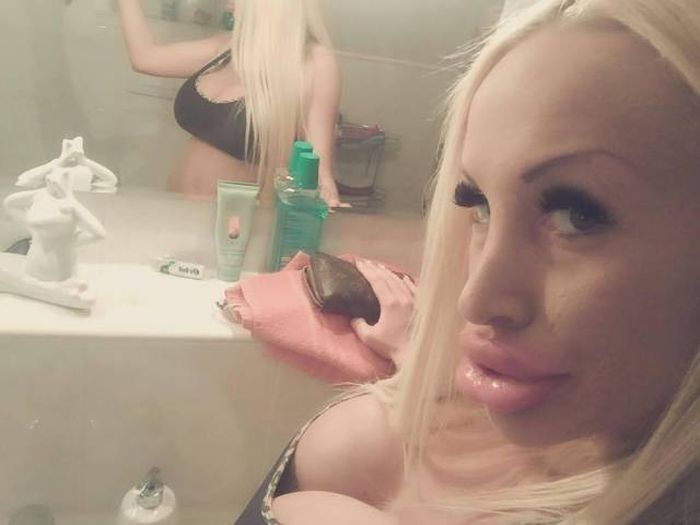 Silicone Beauties Or Horror Stories (22 pics)