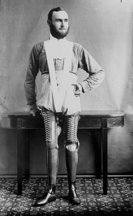Prostheses From 19th Century (20 pics)