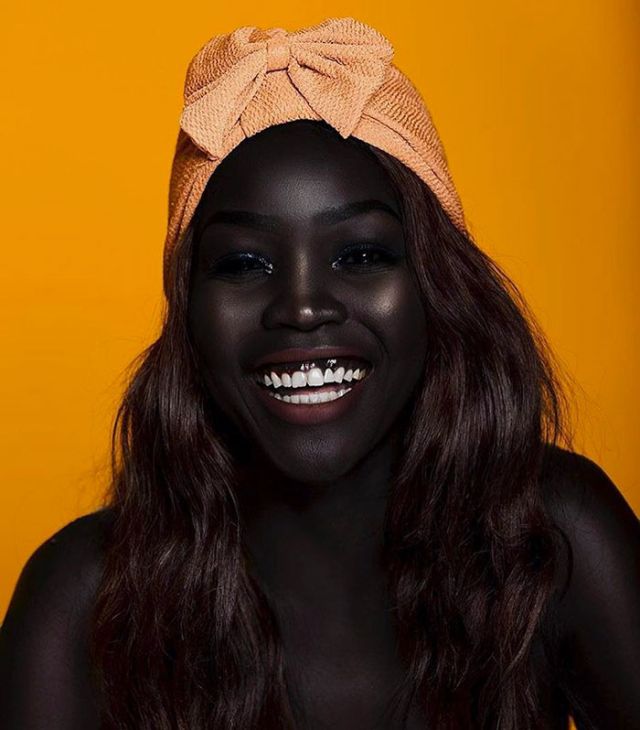 This Girl Has An Incredibly Dark Skin (11 pics)