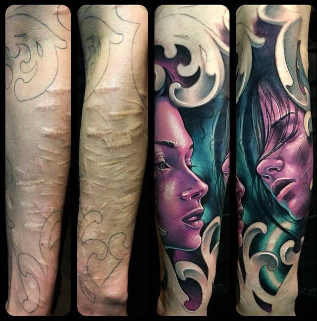 How To Cover Scars With Tattoos (26 pics)