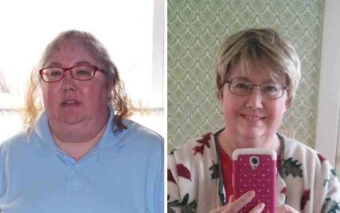 Weight Loss Does Wonders For Your Face (20 pics)