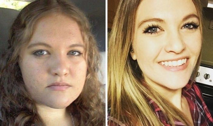Weight Loss Does Wonders For Your Face (20 pics)