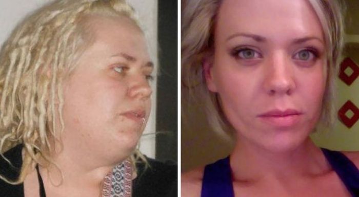 Weight Loss Does Wonders For Your Face (20 pics)