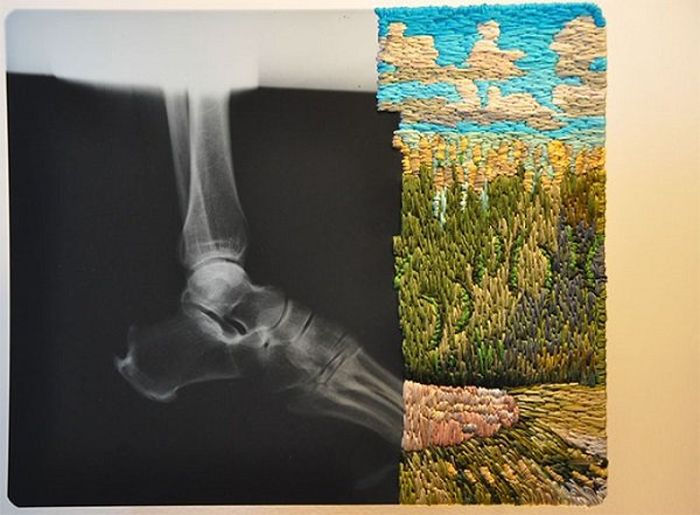 X-Ray Art (23 pics)