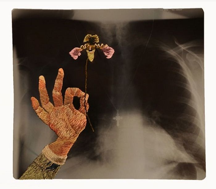 X-Ray Art (23 pics)