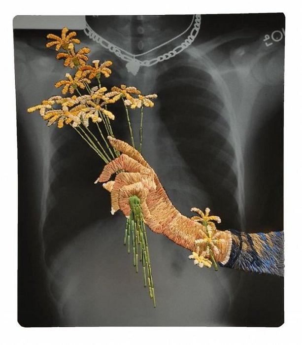 X-Ray Art (23 pics)