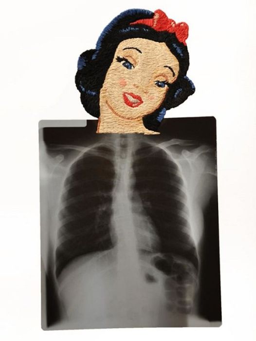 X-Ray Art (23 pics)