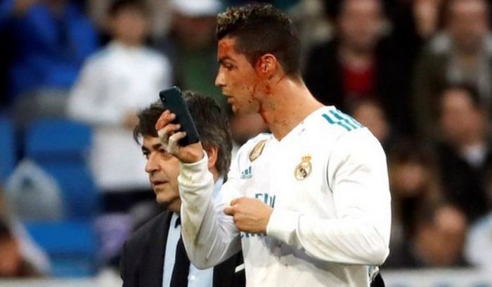 Ronaldo Had To Get A Better Look At His Cut After Getting Kicked In The Head (3 pics)