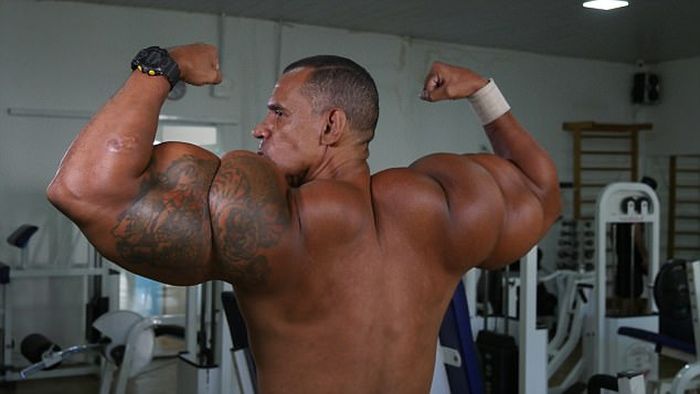 Brazilian Brothers Inject Themselves With Dangerous Chemicals To Create Biceps (6 pics)
