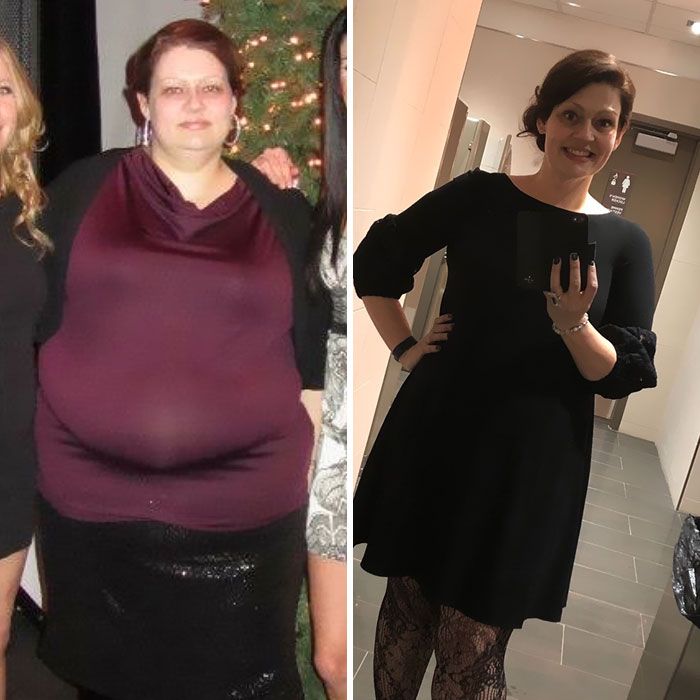 A Woman Lost 150 Pounds (68 kg) (12 pics)