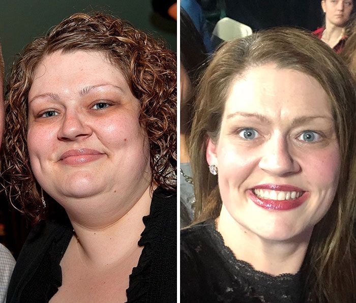 A Woman Lost 150 Pounds (68 kg) (12 pics)